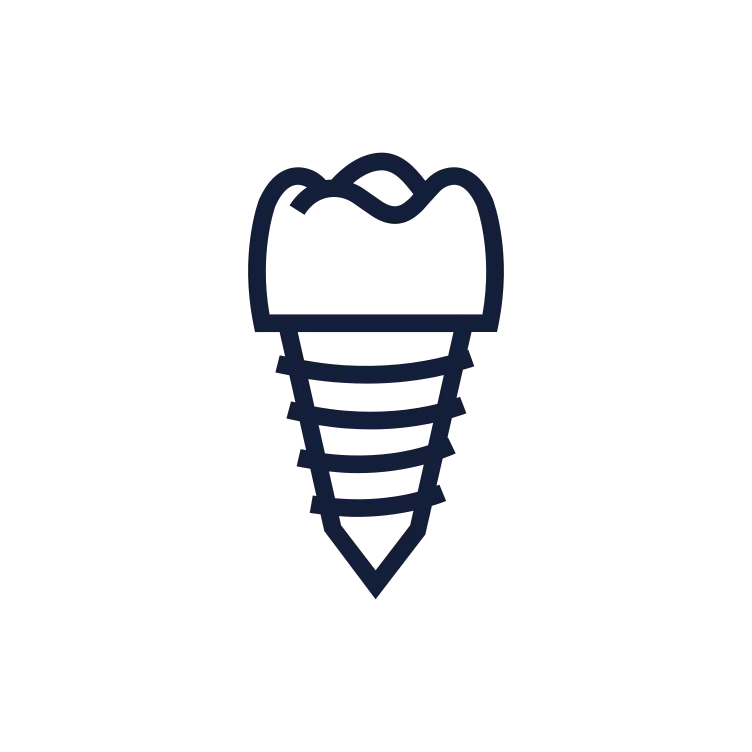 Dental Implants Dental Implants