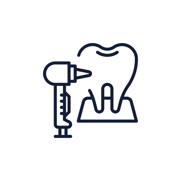 Bone Grafts Bone Grafts